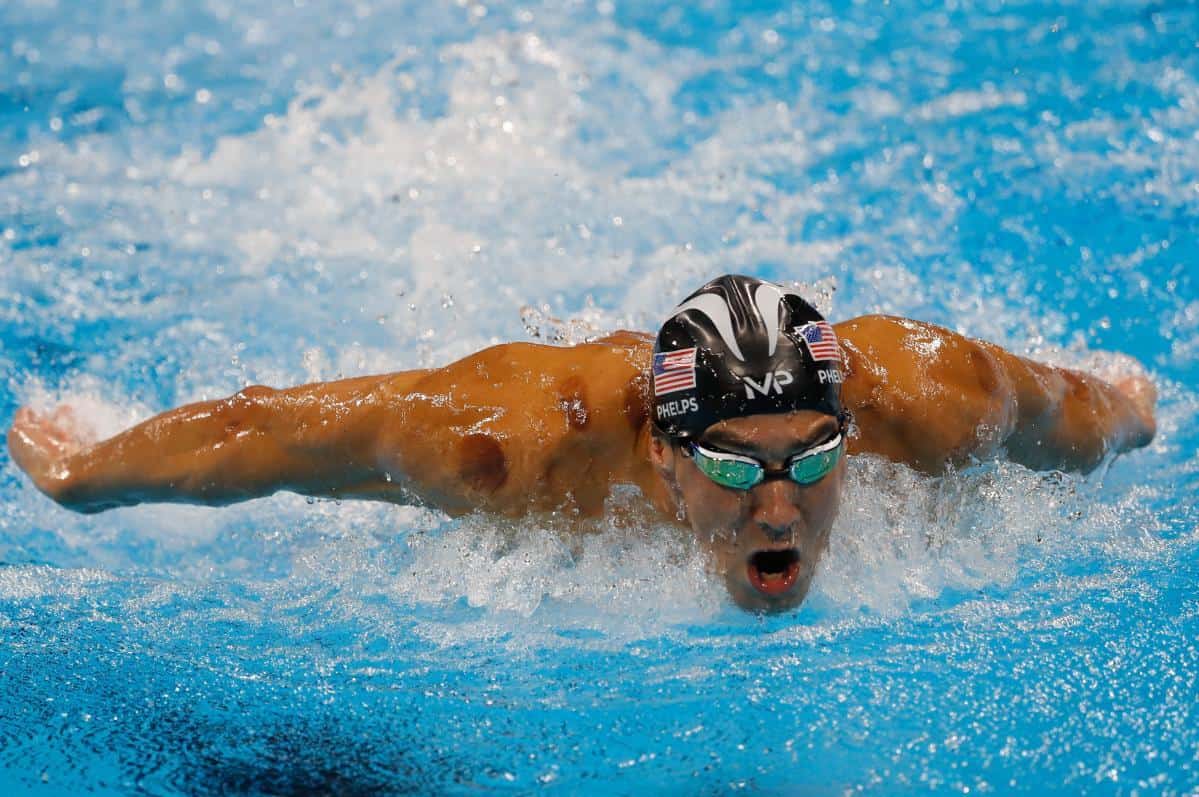 Michael_Phelps_cupping_therapy