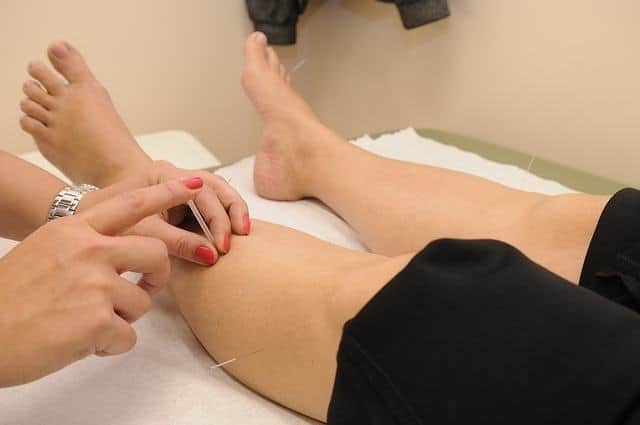 woman legs why acupuncture is good for you