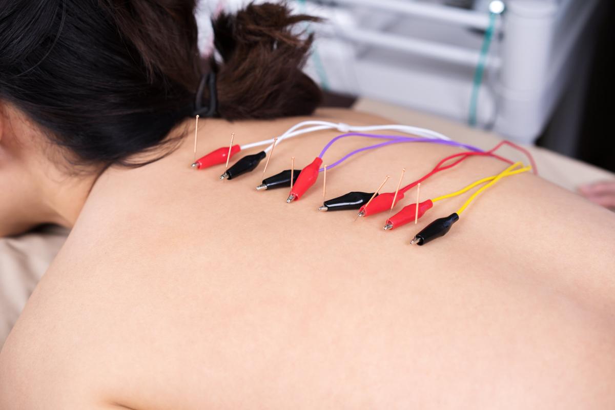 Find Relief Now Acupuncture for Chronic Pain and Inflammation