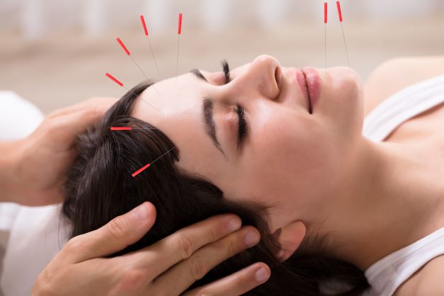 woman facial acupuncture 202171508 DP S tJMtji