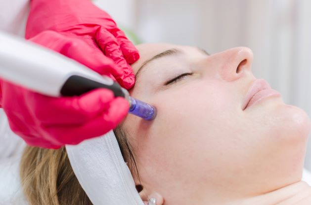 What Is Microneedling All You Need To Know About Microneedling